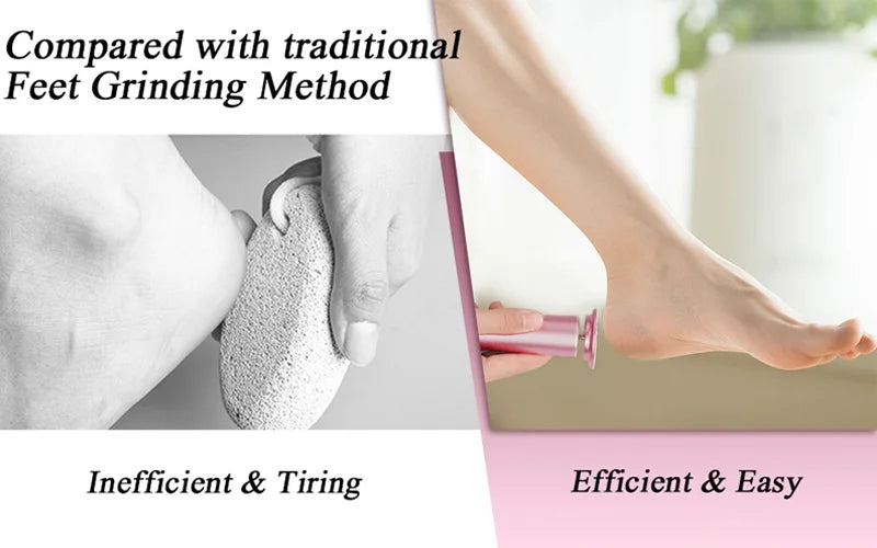 Professional Pedicure Tool Electric Foot Callus Remover File Foot Grinder Dead Skin Callus Remover Pedicure Machine