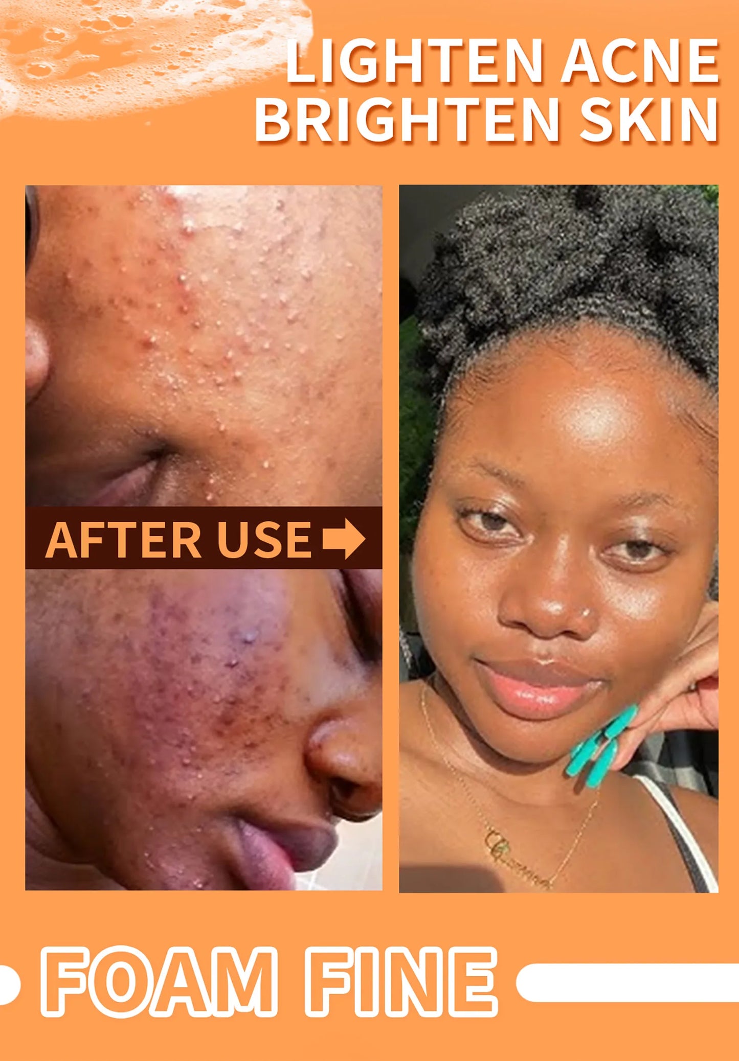 Natural Turmeric Whitening Body Wash, Deeply Clean Skin, Remove Dark Spot, Pimple, Acne, Smooth Skin, For Face & Body Soap Bar